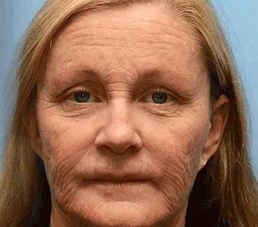 🎁AllyBee® Last Chance! 70% OFF Skin Repair Cream,Fade scars, smooth skin, and glow naturally. Free air shipping & risk-free for 180 days.