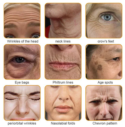 🎁AllyBee® Last Chance! 70% OFF Skin Repair Cream,Fade scars, smooth skin, and glow naturally. Free air shipping & risk-free for 180 days.